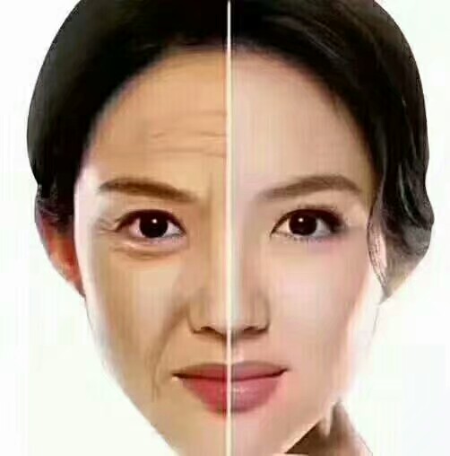 清洁皮肤毛孔里的黑头污垢,全身皮肤毛孔堵塞怎样清洁