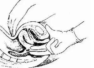 经期没干净可以做妇科检查吗,为什么没结婚不能做妇科检查