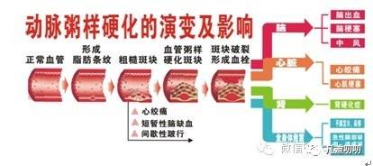 腰围的决定因素,腰围是天生的吗