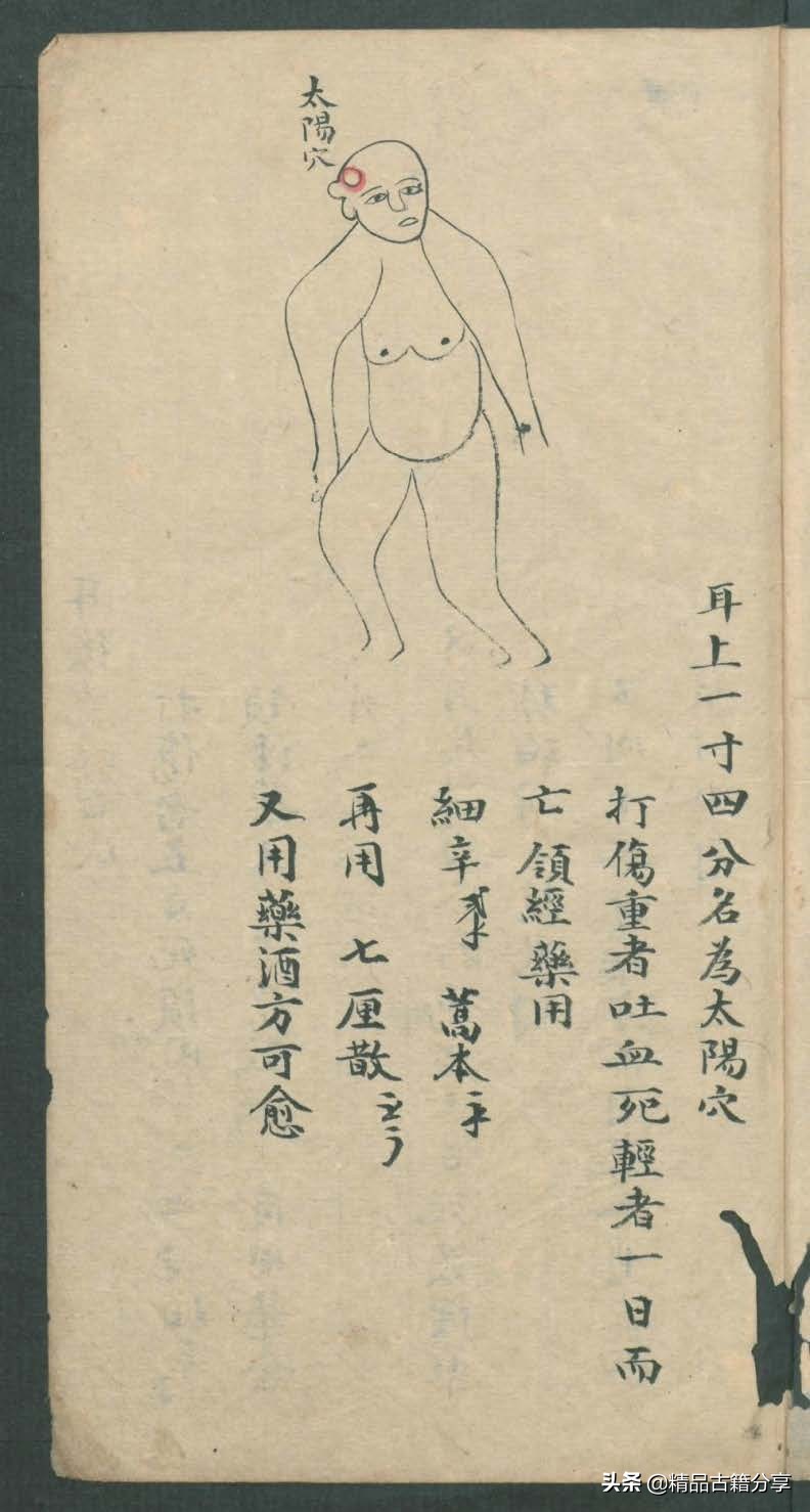 中医类抄本跌打损伤方面的医书欢迎阅读