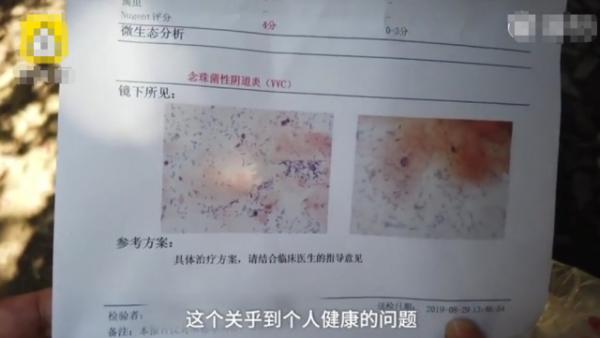 女子疑买到假避孕套感染真菌,女子疑便利店买到假避孕套感染