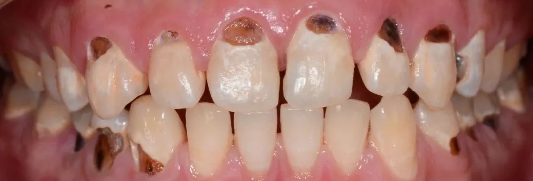 牙医从业感悟,牙医忠告11条