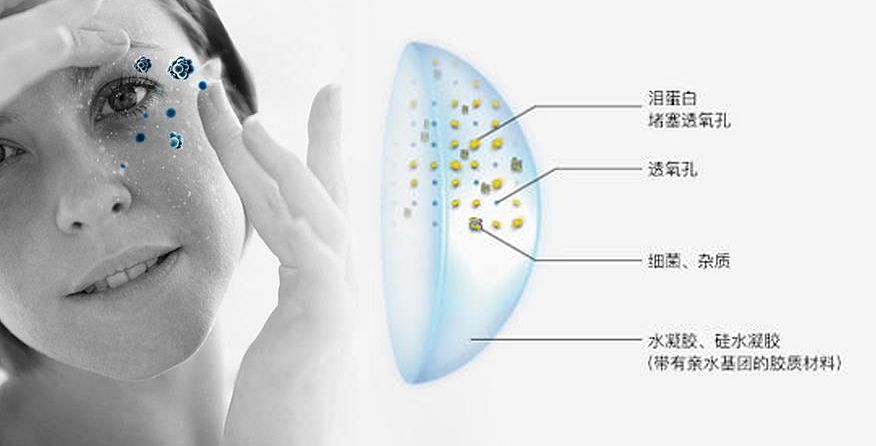 隐形眼镜清洁器升级版,智能隐形眼镜清洗器