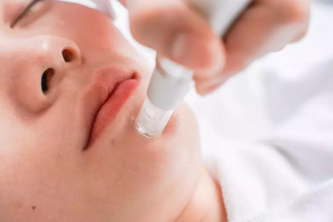 我花99块钱就泡到了我们公司的“彭于晏”!