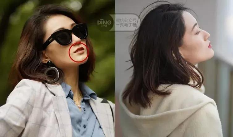 整牙一年半,这次重点说说整牙给我带来的小困扰