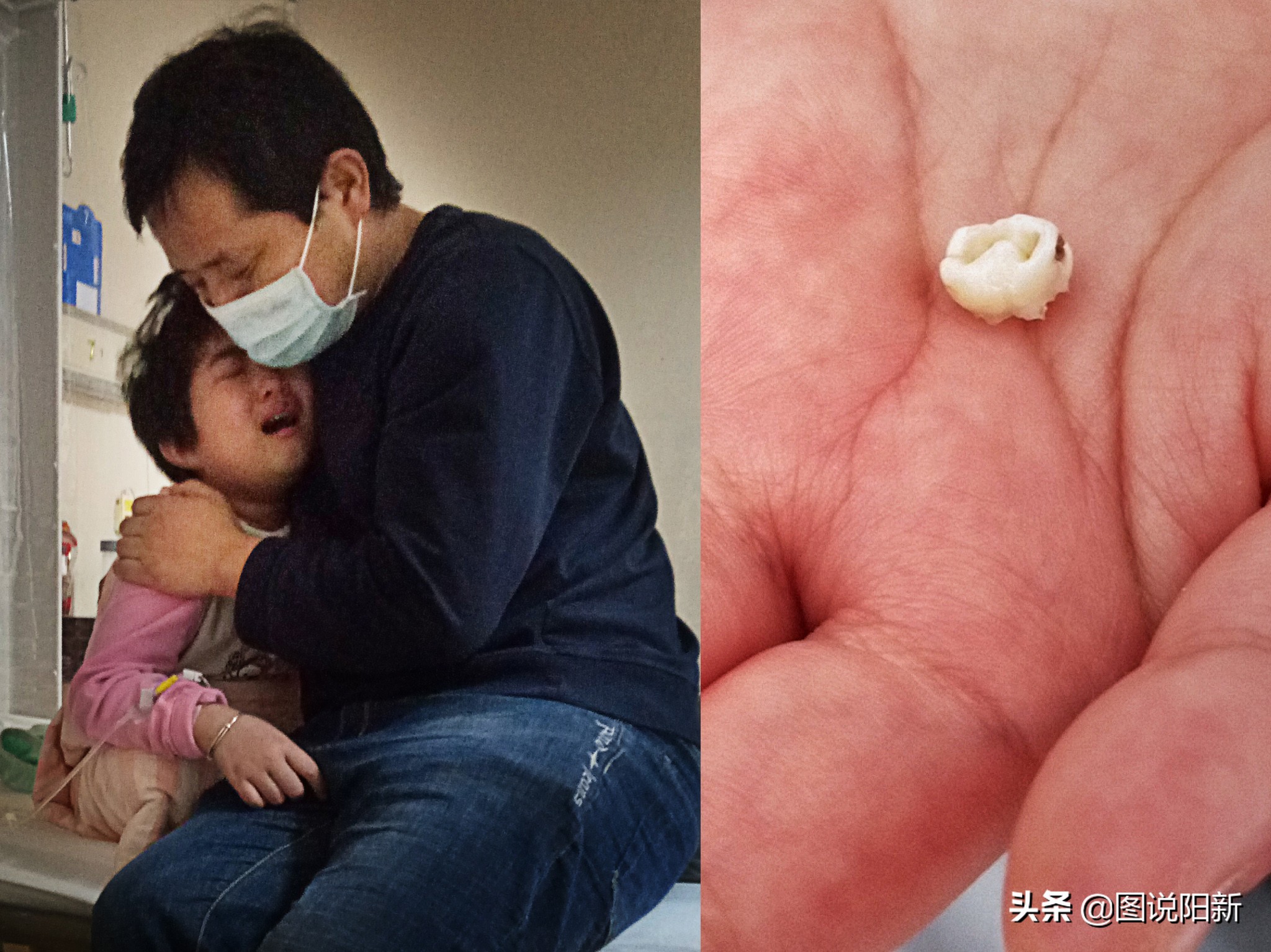 女孩患了200万分之一罕见病,女孩身患罕见怪病