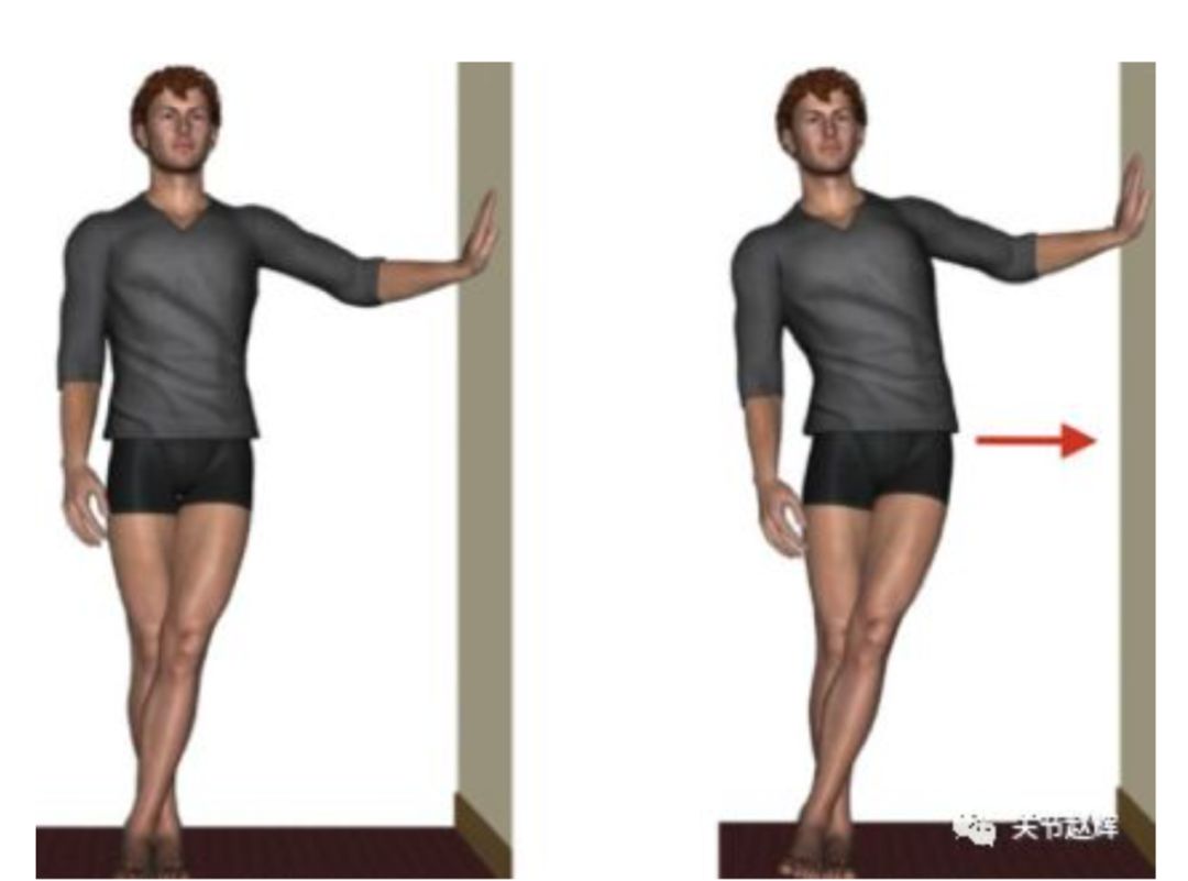 跑步伤膝的预防方法,跑步膝如何纠正