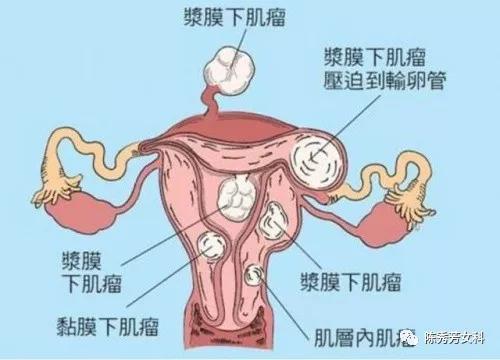 王熙凤血崩是怎么回事,王熙凤的血山崩原因