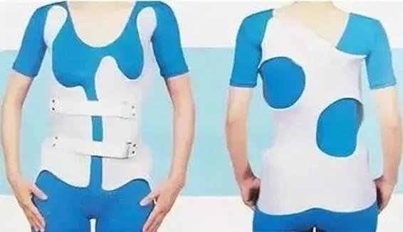 我国青少年脊柱侧弯占1%到2.7%,青少年脊柱侧弯40度矫正方法图解