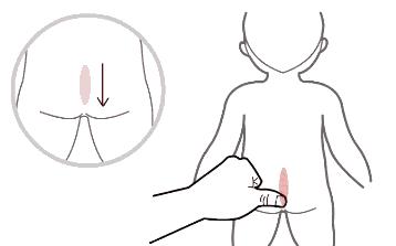 小儿推拿补脾胃拉肚子最快的方法,宝宝受凉拉肚子中医治疗法