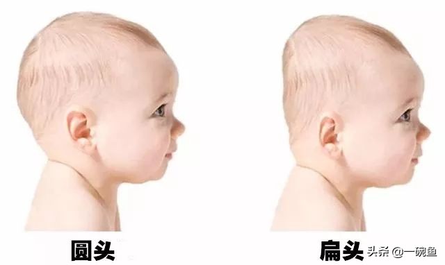 天生头扁怎么矫正,天生头扁在医学上怎么弄