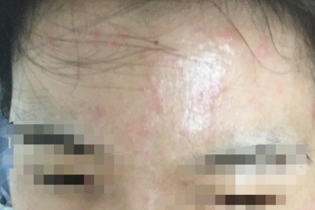 a醇视黄醇精华30ml,视黄醇跟a醇精华区别