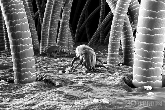 脸上的螨虫洞会愈合么,脸上螨虫挤出来有个洞用什么药膏