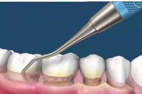 推荐的低龄儿童刷牙方法,儿童正确的巴氏刷牙方法