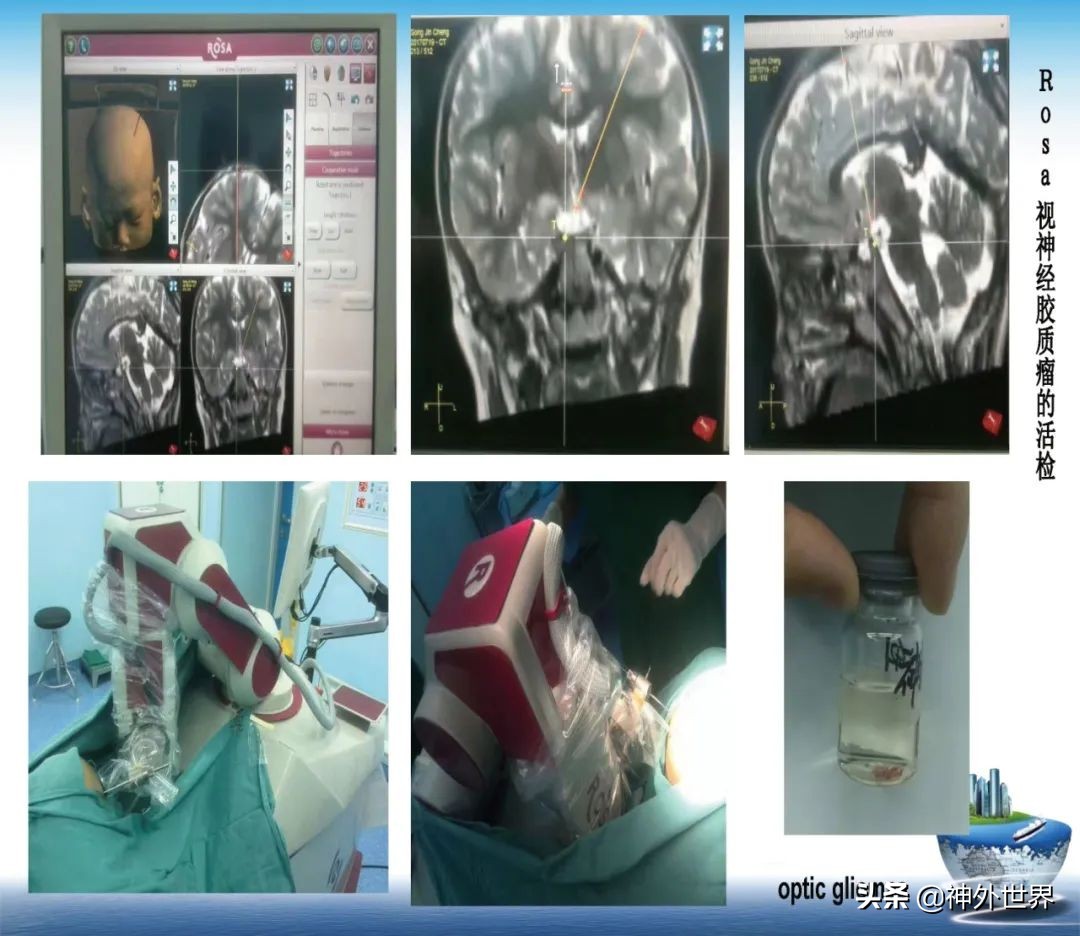 宣武医院神经外科王亚明祖籍,北京宣武医院神经科专家王亚明