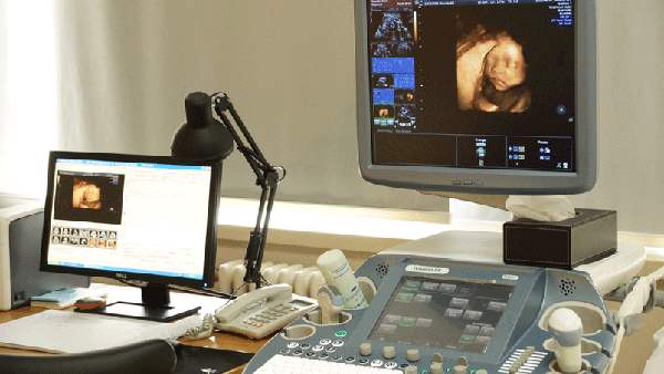 孕检做四维彩超，胎宝可能不配合，孕妈想要一次成做好这四点