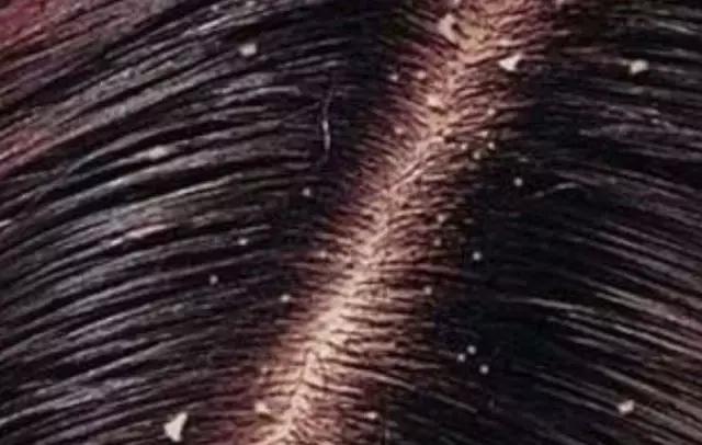 阿司匹林生活小技巧,阿司匹林正确吃法消炎