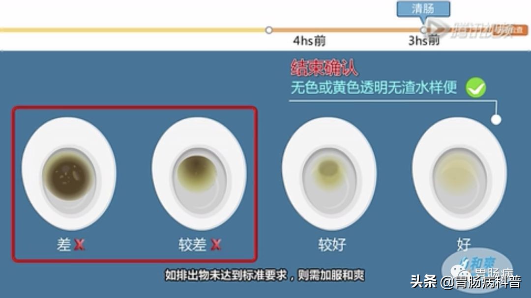 做肠镜是怎么清肠的,做肠镜如何能清肠
