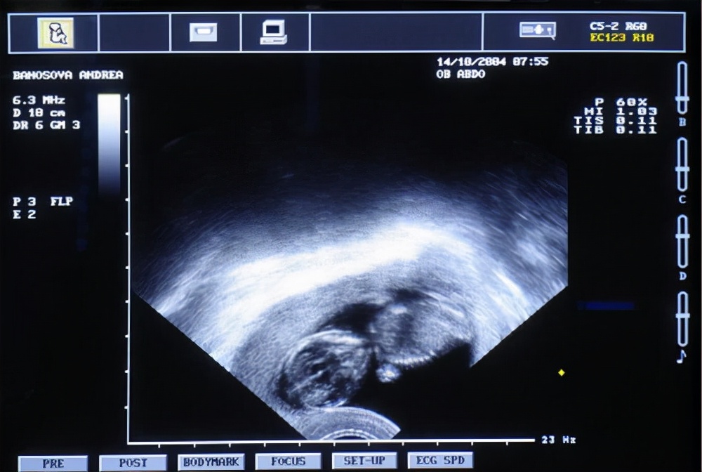 妇科阴式b超探头是一次性的吗,阴式b超都能检查什么