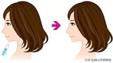 佛山华美好不好,佛山华美整形美容医院高明区