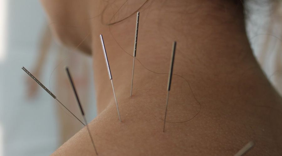 缓解颈椎痛的最有效方法,脖子颈椎痛怎么办快速缓解疼痛