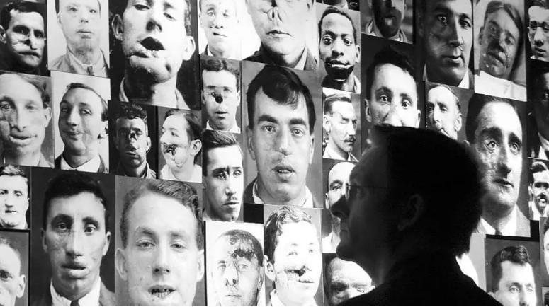 世界第一例整容手术如何诞生的,世界上最早出现的整形医院