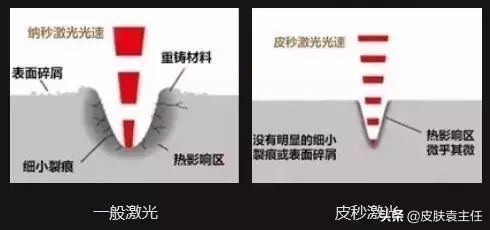 遮瑕遮不住雀斑怎么办,什么样的遮瑕可以遮掉雀斑