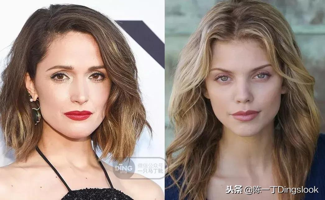 颧骨高太阳穴凹陷怎么改善脸型,颧骨宽大太阳穴凹陷快速改善