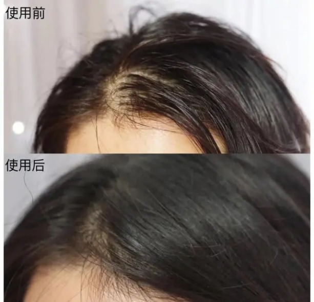 飘柔止痒海飞丝洗发水,海飞丝控油蓬松洗发水真实测评