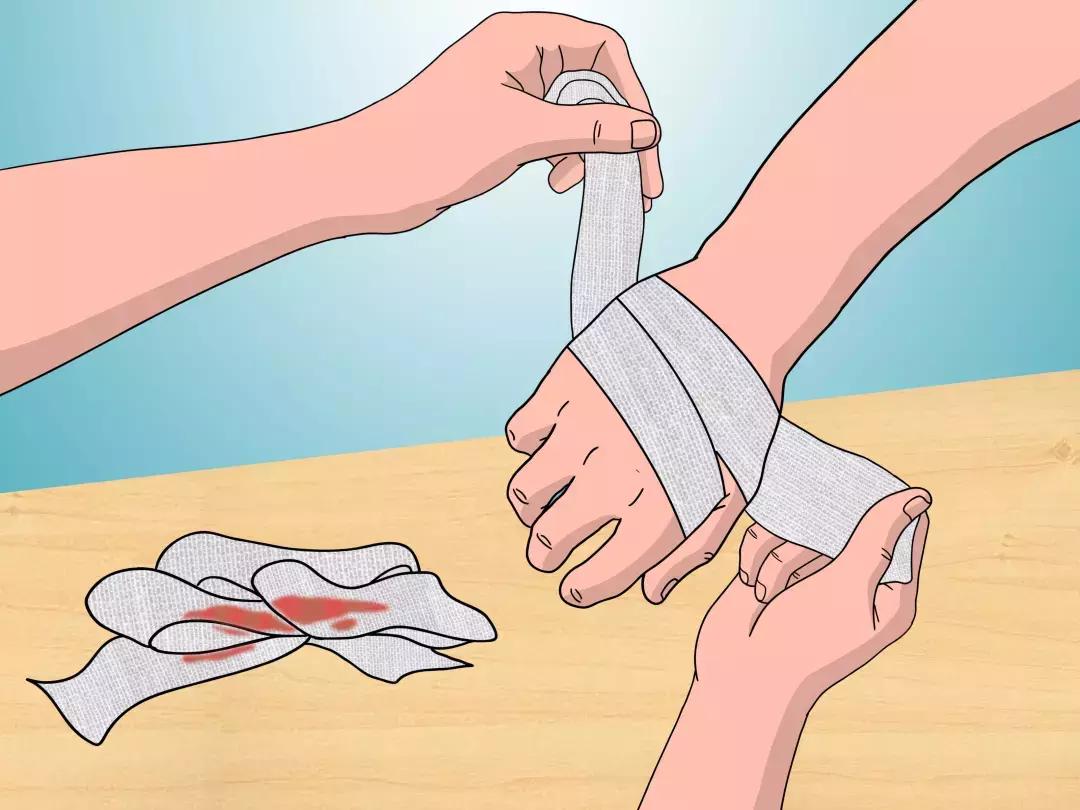 烧伤常见的护理诊断,常见的烧伤医疗诊断方法有哪些