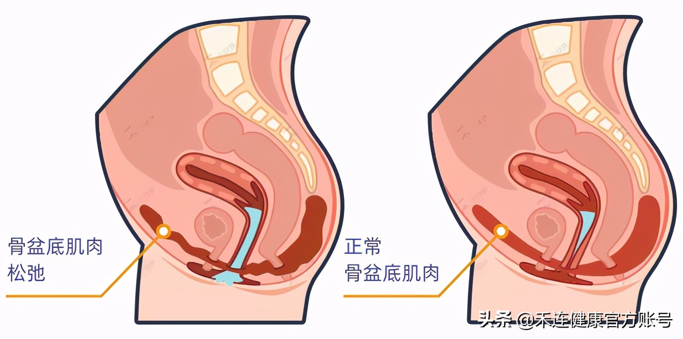 尴尬！同房时*处私**发出“噗噗”声，咋回事？