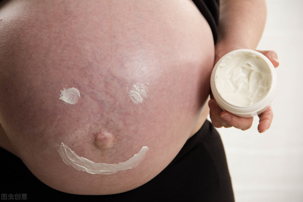 妊娠纹很严重和体质有关系吗,长妊娠纹注意这4要点