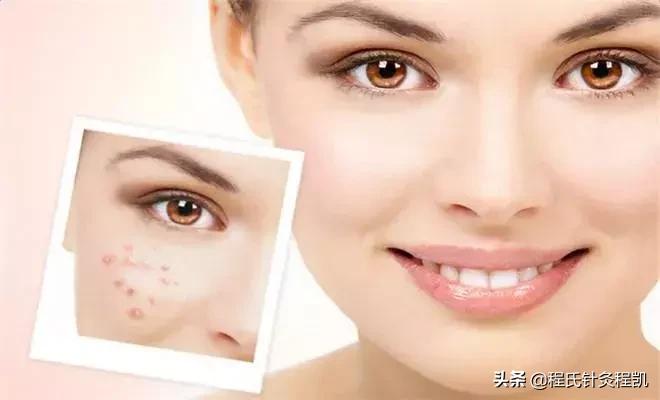 舌底下长疮按什么穴位,嘴唇里外生疮中医上按哪个穴位