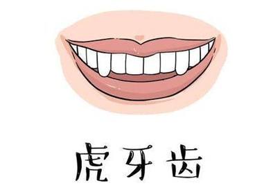 “*牙虎**这么多余,可以拔了吗?”看看明星你就知道答案了