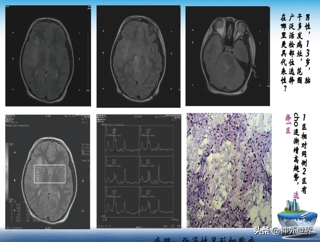 宣武医院神经外科王亚明祖籍,北京宣武医院神经科专家王亚明