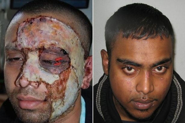 化学品灼伤案例,触目惊心的各种突发安全事故