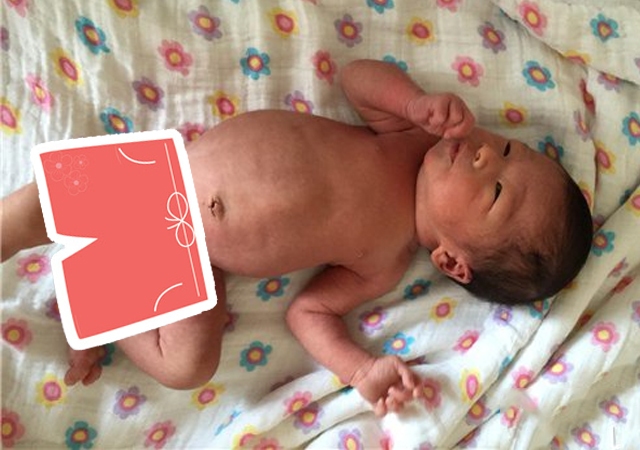 宝宝肚子鼓得像气球,肚脐眼周围胀气鼓得像气球