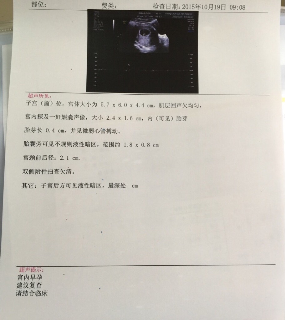 胎儿是怎样形成的全过程,胎儿形成的全过程图