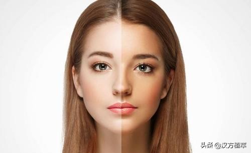 做斑一年了皮肤有点红,做斑后会变得很老吗