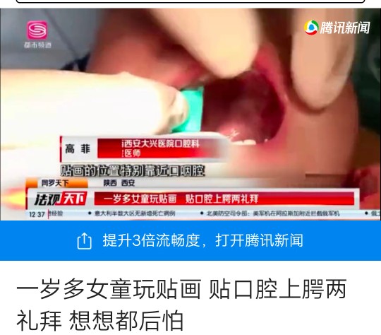 宝宝误吃异物拍ct没有发现,宝宝误食不明异物