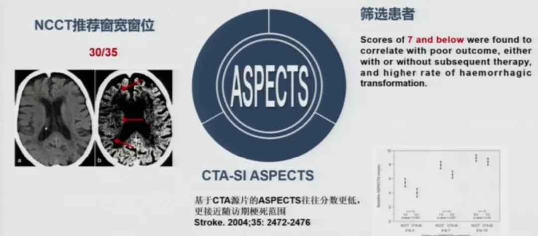 急性脑中风影像诊断选择,急性脑卒中首选哪种检查方法