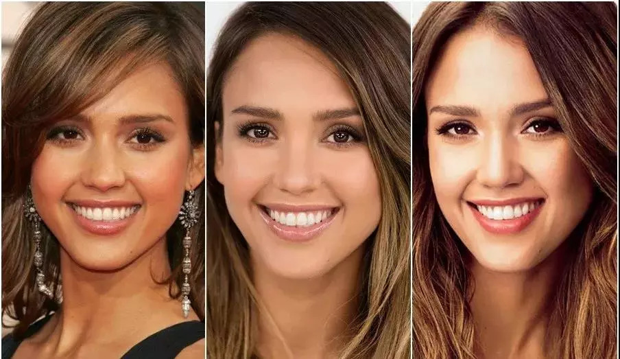 本人连续治疗12颗牙的痛快经历