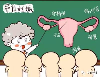 协和妇科宫外孕,崇州市妇幼保健院医疗事故