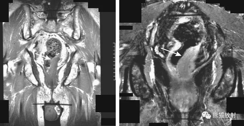 腹部影像图片大全,乙状直肠疼痛位置图片