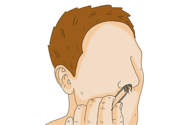 42岁鼻毛变白一定是衰老吗,鼻毛变白是衰老的前兆吗