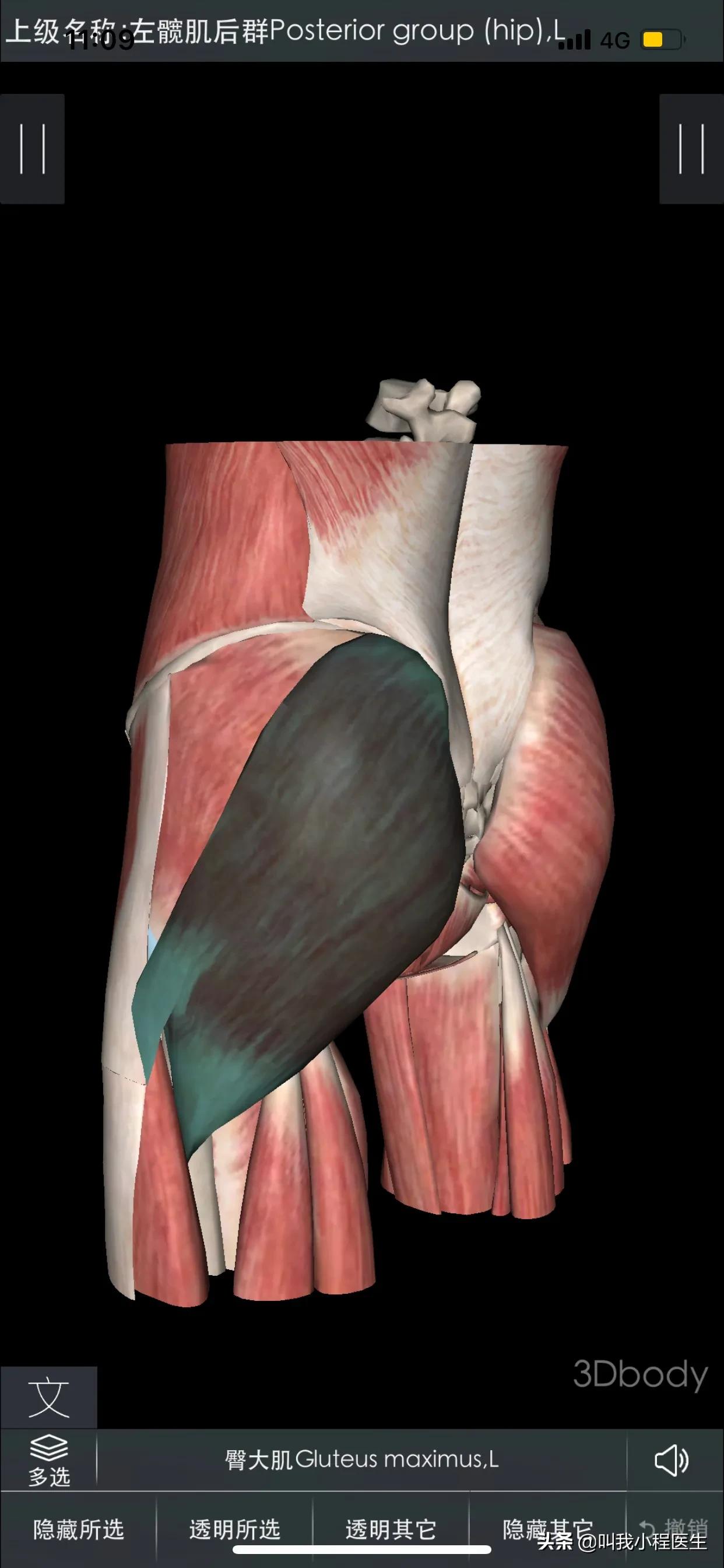腰椎间盘突出和骨质增生怎样缓解,抗骨质增生片对腰间盘突出有效吗