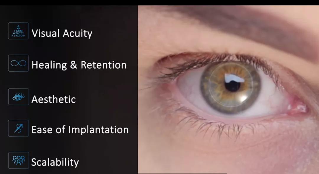 世界第一例眼角膜移植手术,我国首例眼角膜移植手术