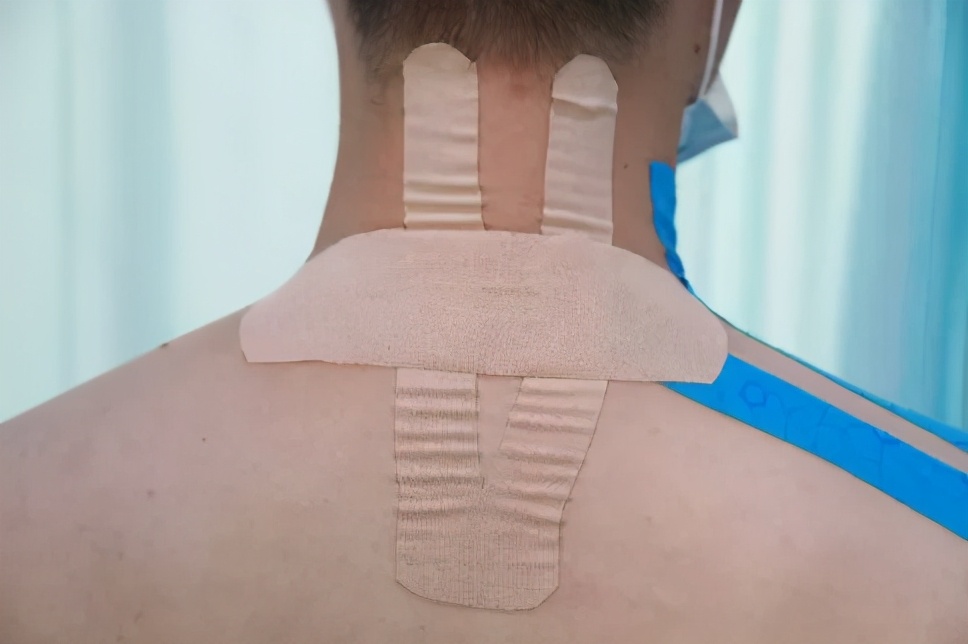 弹性贴布的原理,弹性贴布的作用