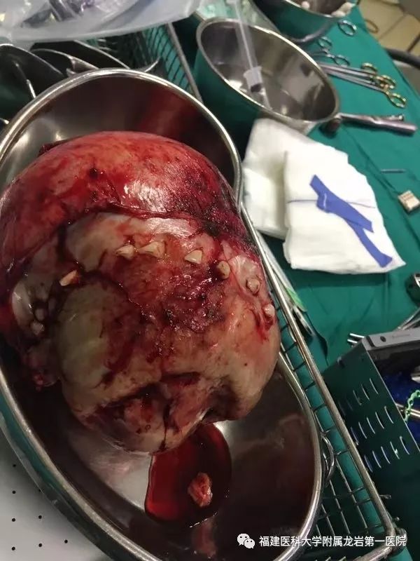 龙岩第一医院：医道*界无**，远赴非洲，让胸前的五星红旗更加闪耀