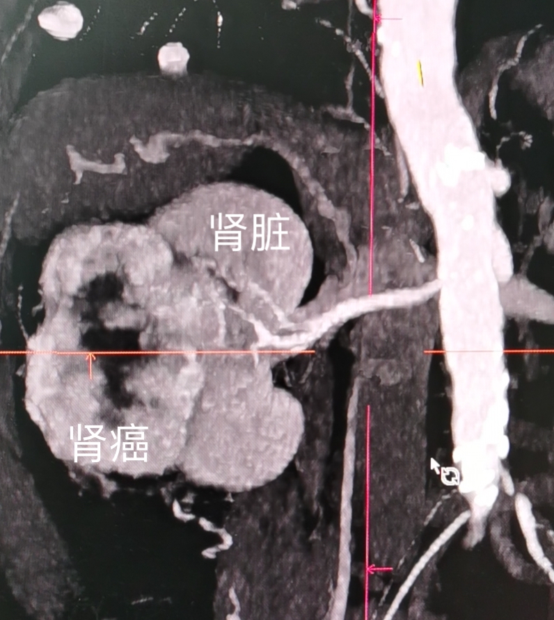 医院泌尿外科都看些什么病,哪些病需要去看泌尿外科